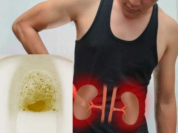 Đi tiểu có bọt có nguy hiểm không? – Bệnh Viện An Việt
